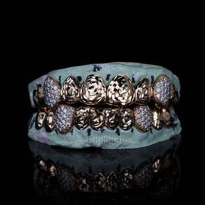 Parrillas personalizadas APORRO Premium personalizadas