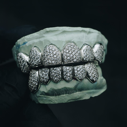 Custom Zig Zag Setting Iced VVS Moissanite Grillz